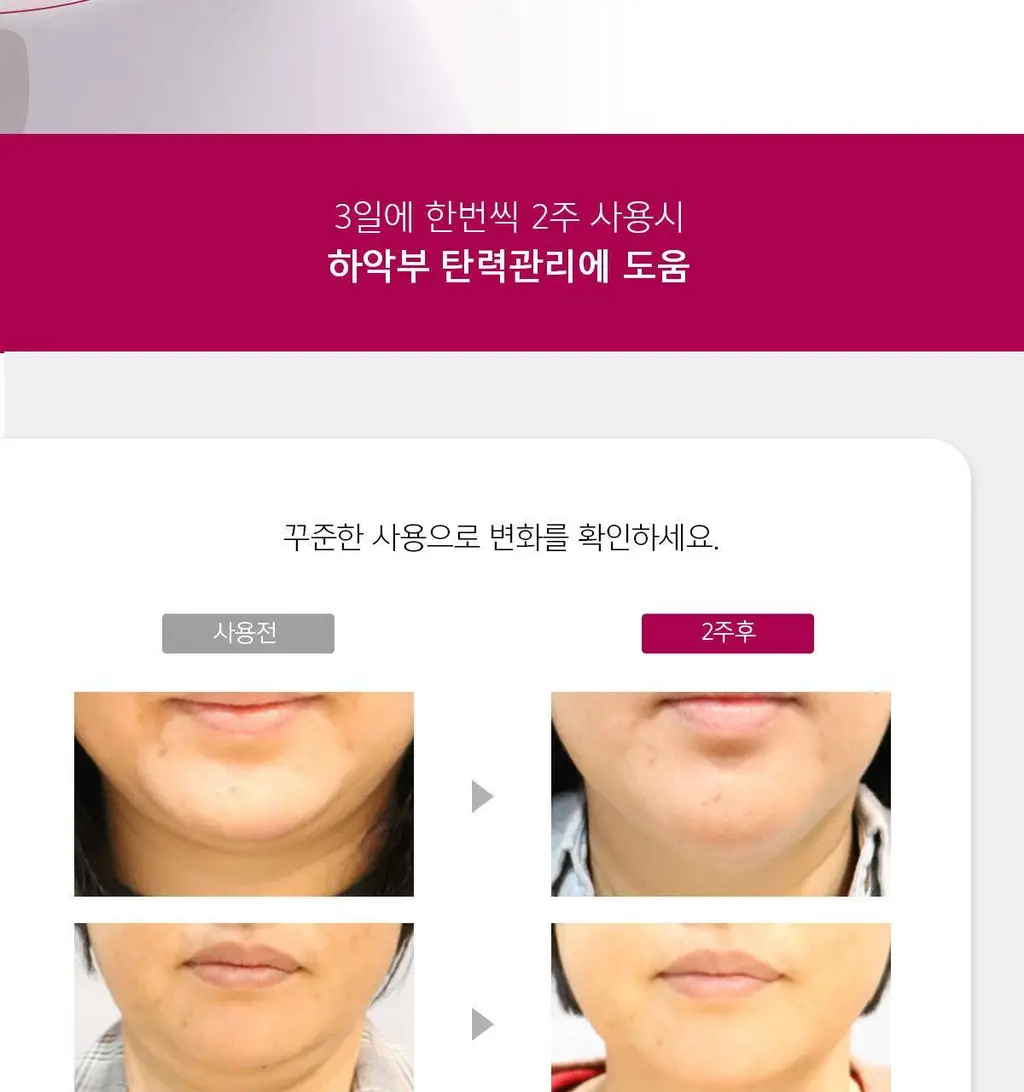 [브이라인/리프팅 패치] 아나시스 벨라컨투어 듀얼리프트마스크 5매 상세페이지 8